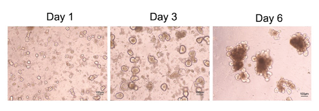 Confocal microscopy of mouse intestinal organoid growth with growth factors