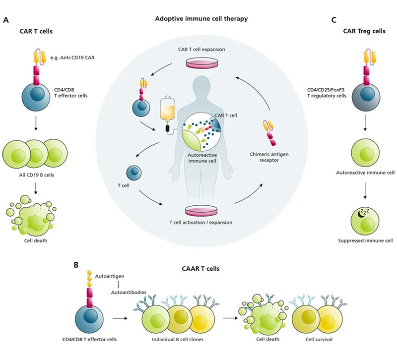 CAR-T Cell Therapy for Autoimmune Diseases