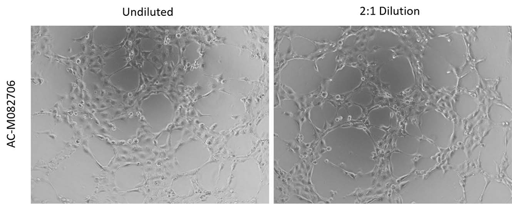 Angiogenesis Assay