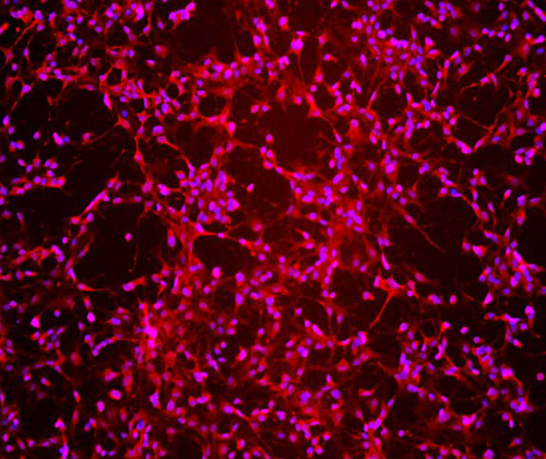 The specificity of Tbr1 antibody was verified by immunofluorescence