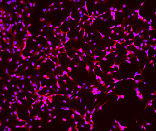 The specificity of GFAP antibody was verified by immunofluorescence