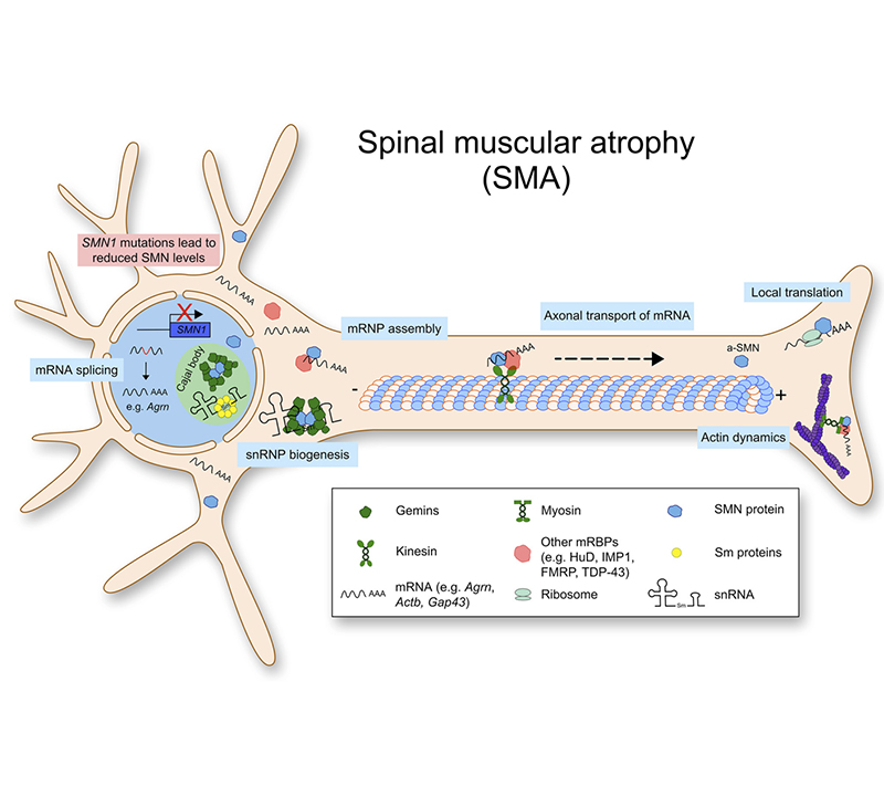 Atrofia muscular espinal (AME)