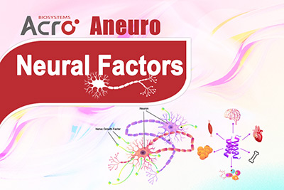 Neural Factors