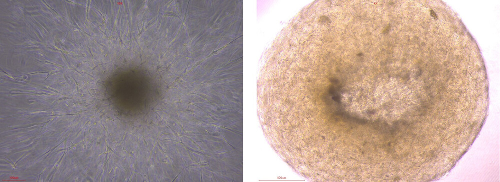  VEGF110 ORGANOID CULTURE