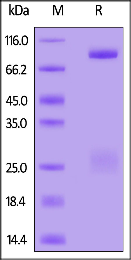 Glycoprotein H & Glycoprotein L (EBV) SDS-PAGE