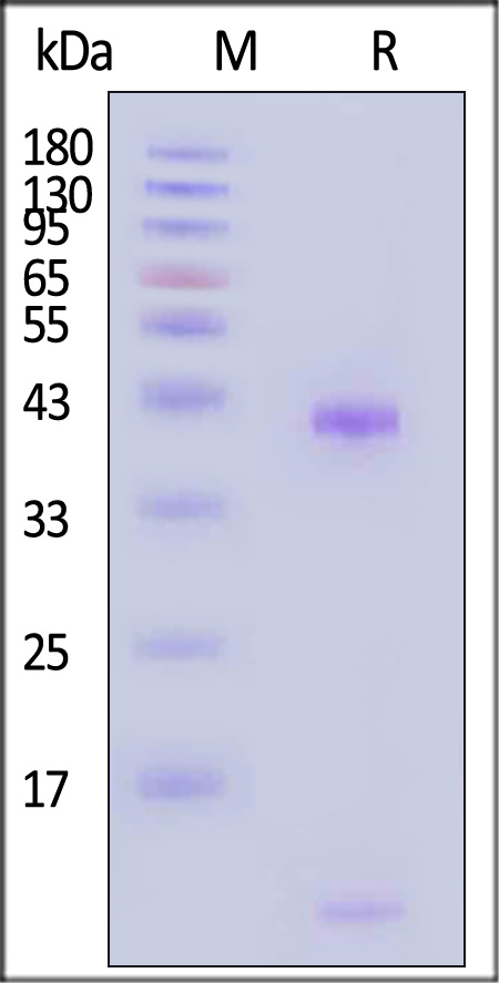 HLA-A*0201 & B2M & HPV (TIHDIILECV) SDS-PAGE