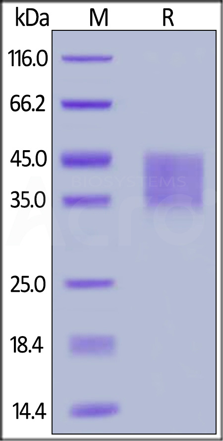 IFN-alpha/beta R2 SDS-PAGE