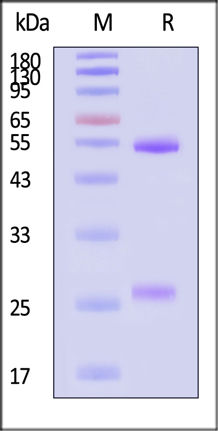 Neuraminidase (NA) SDS-PAGE