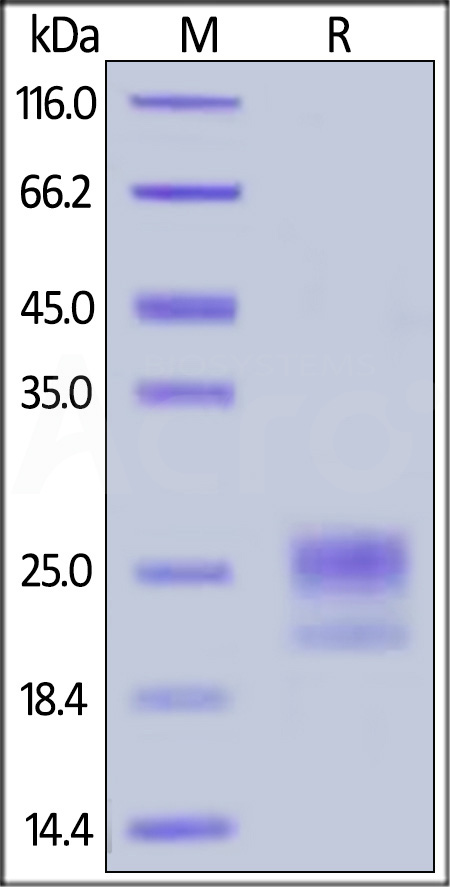 Human NPC2, His Tag (Cat. No. NP2-H52H1) SDS-PAGE gel