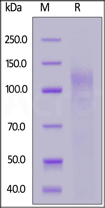 Spike S1 SDS-PAGE