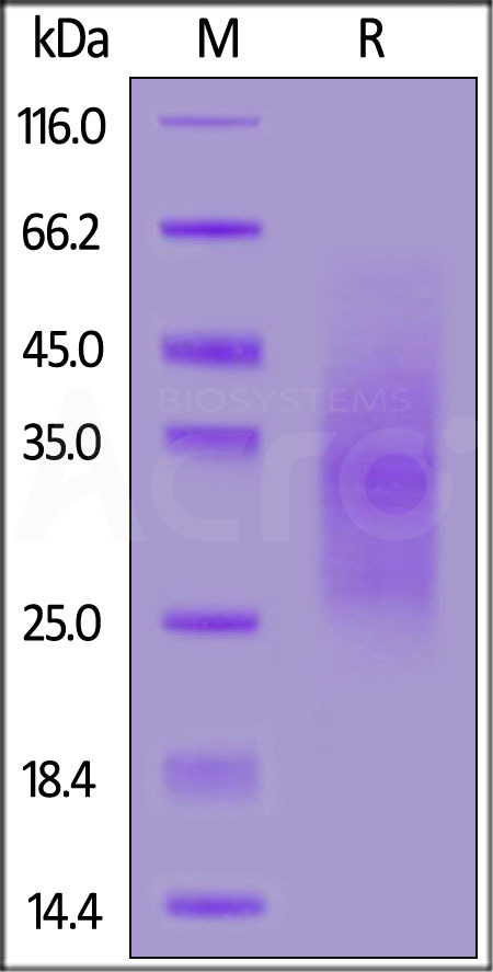 TGF-beta RII SDS-PAGE